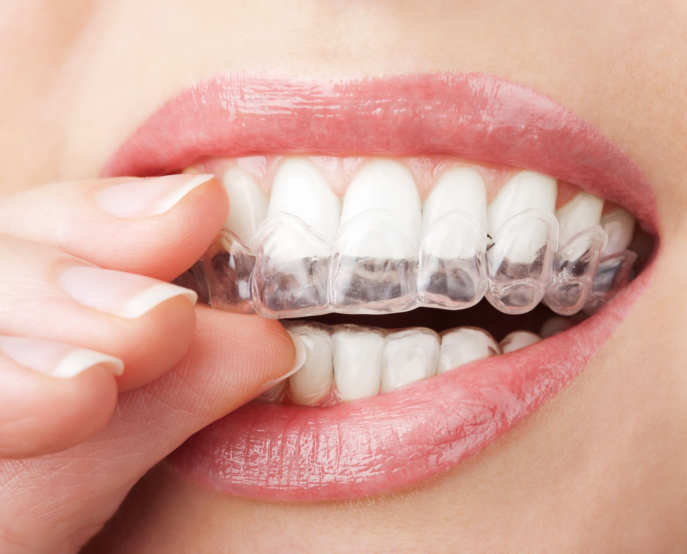 Find Out More About Invisalign in Bayside, NY