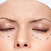 Finding an Excellent Plastic Surgeon