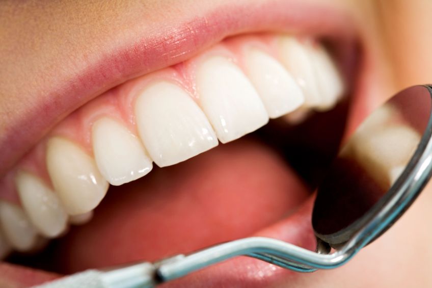 Get The Most Out Of Cosmetic Dentistry in St. Peter, MN