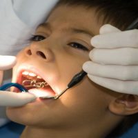 What does a general dentist do?