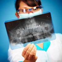 The Purpose of Getting Annual Dental X-Rays in Del City OK