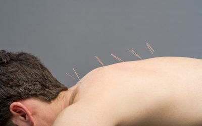 What Can You Do With an Acupuncture Degree?